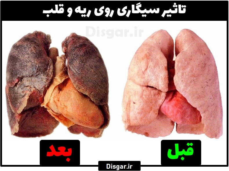 آزیترومایسین برای جوش صورت و ترک سیگار