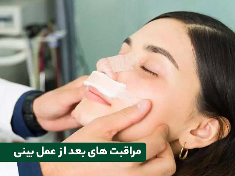 آشنایی با مهمترین مراقبت‌های بعد از عمل بینی